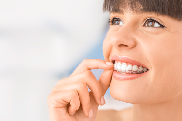 Invisalign Oldsmar